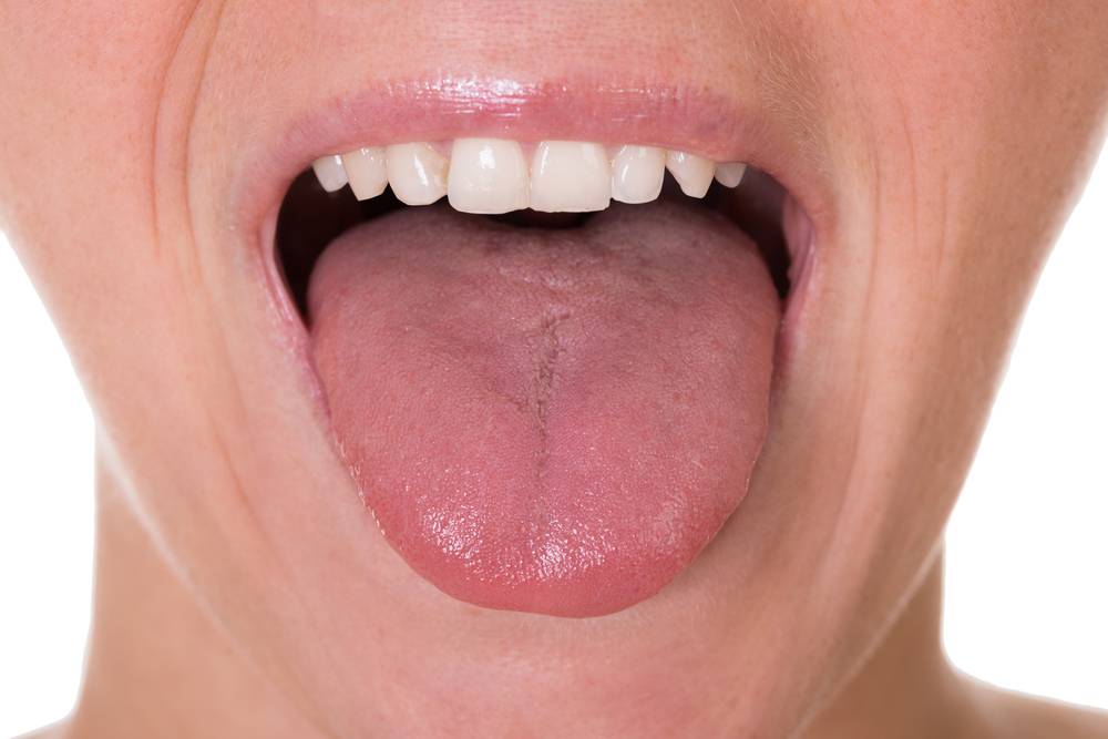 伸脷即知有冇「黐脷筋」言語治療配合口肌訓練改善問題