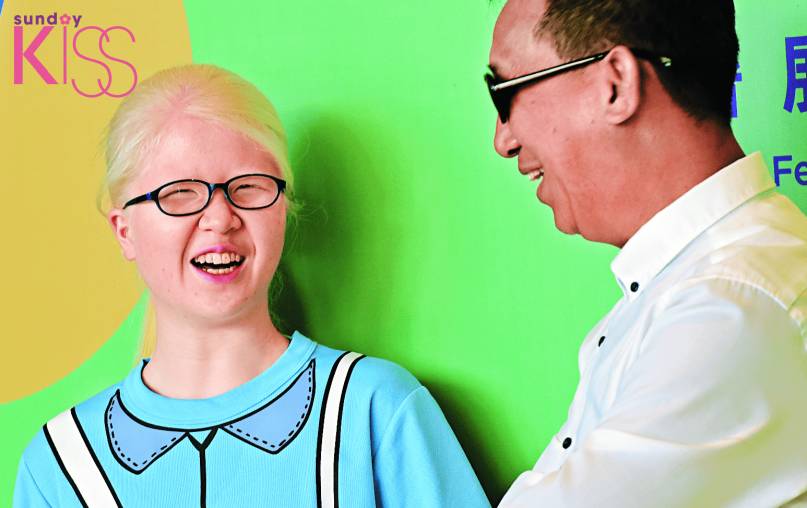 白化病 Ben Sir 認為麗銘早已衝出自己的病患限制，不怕自嘲去帶出視障者的日常。