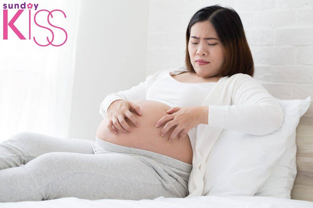 懷孕中周身痕不一定是孕婦濕疹！醫生教認清3個痕癢原因＋舒緩方法