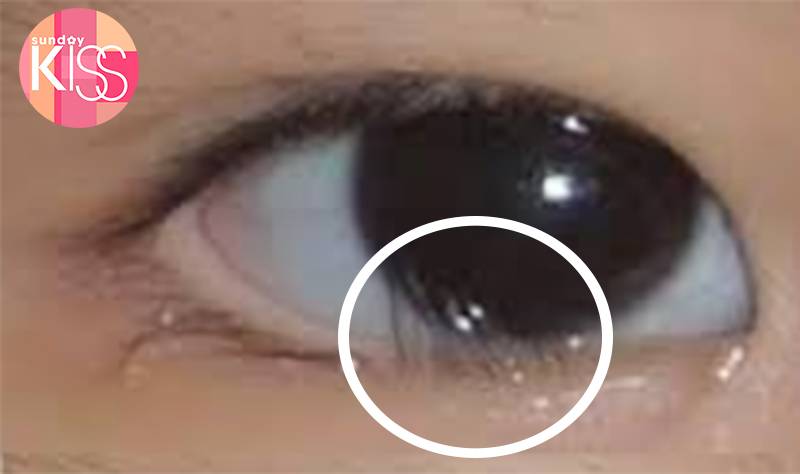 睫毛倒生 倒生睫毛多位於眼角後位置。
