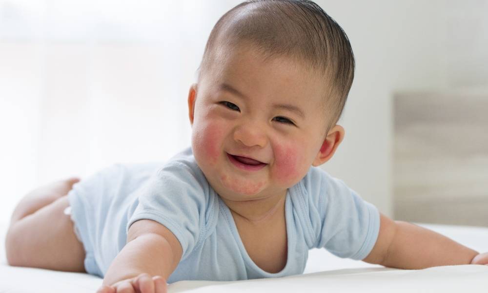 4款紓緩濕疹洗頭水及沐浴露＋28款BB濕疹Cream潤膚膏推介 美國濕疹協會＋水中銀