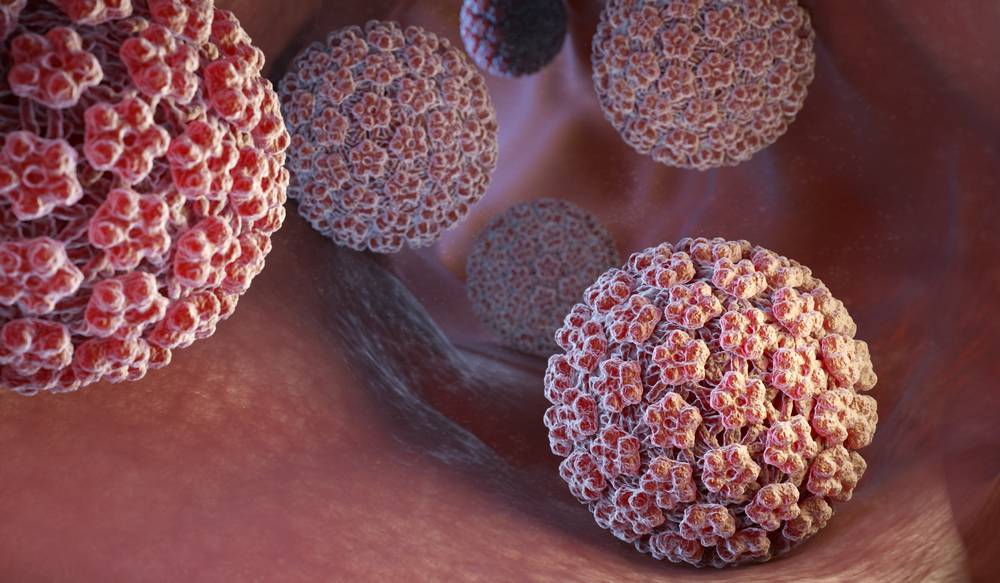 某些HPV 病毒可以導致生疣