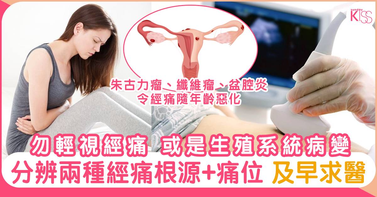 勿輕視經痛 或是生殖系統病變 | 分辨兩種經痛根源+痛位 及早求醫