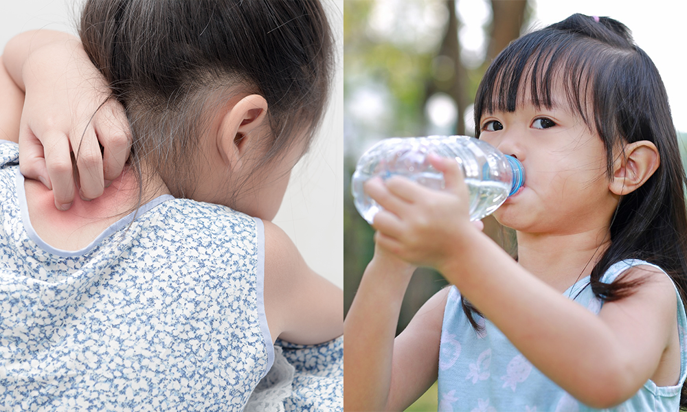 10歲女孩用膠樽當水壺飲水1年 導致濕疹發作兼提早發育來月經
