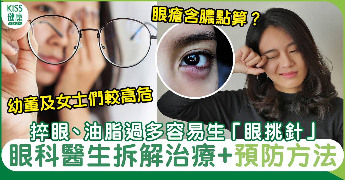 眼挑針/眼瘡處理方法｜眼科醫生：熱敷有效治療捽眼化妝容易誘發