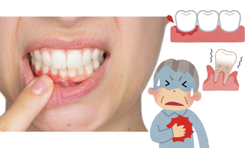 牙周病或會影響心臟健康 懶刷牙、蛀牙問題勿忽視！