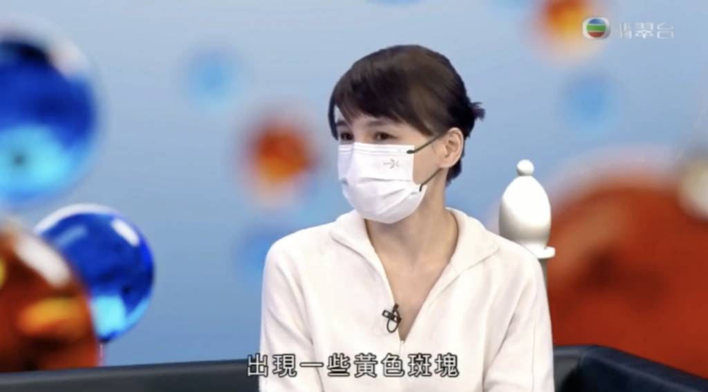 女性更年期 預防心血管疾病
