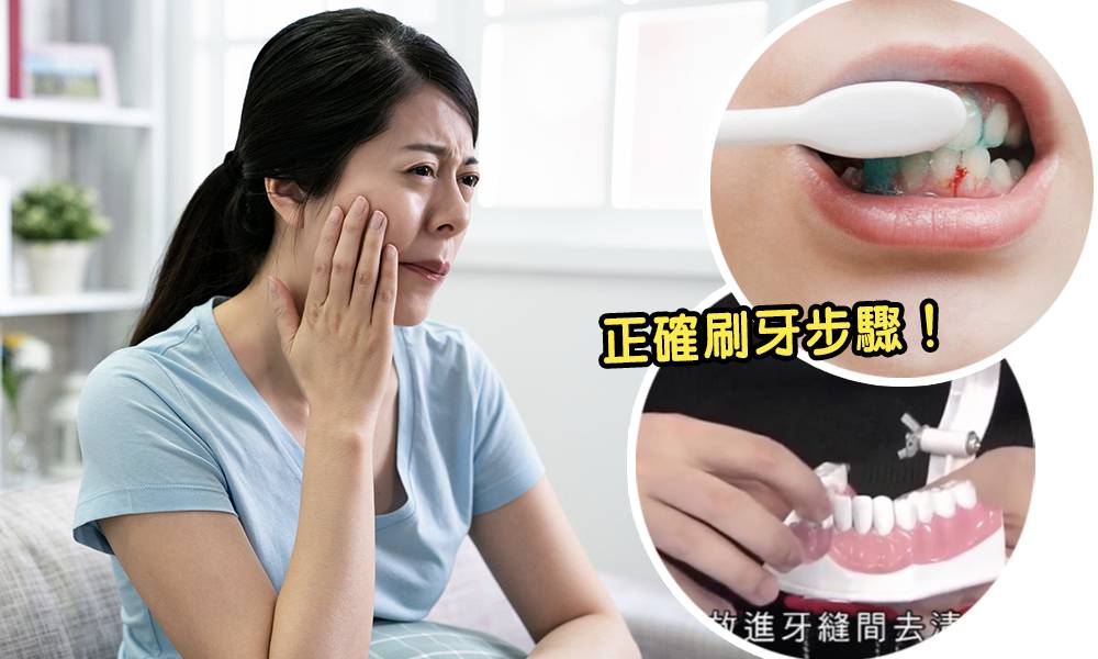 牙周病成因＋治療｜牙科醫生教3個正確刷牙步驟預防蛀牙