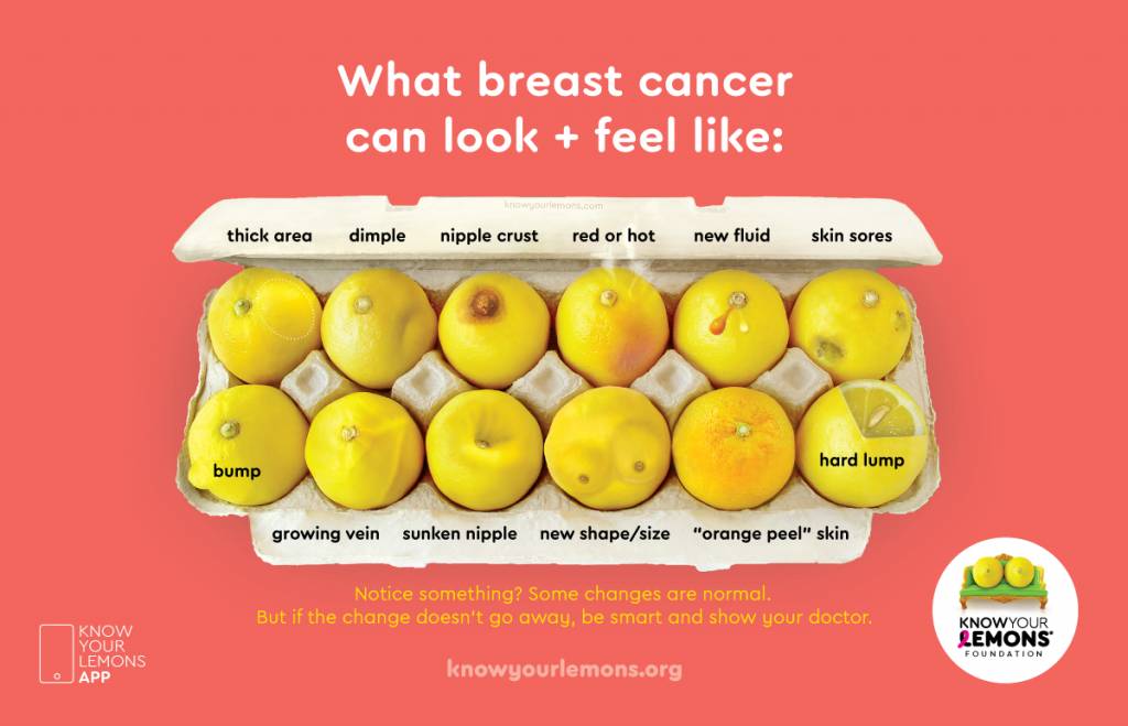 乳癌檢查很重要