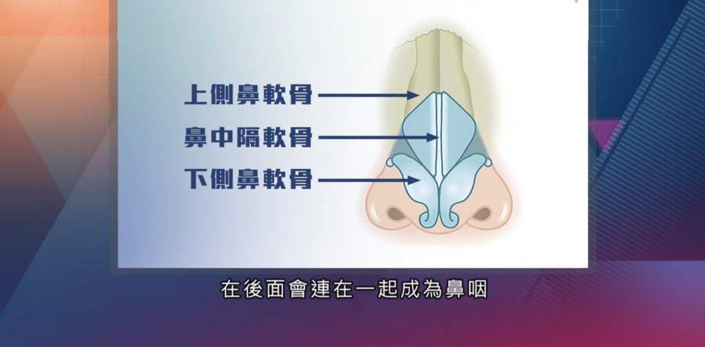 流鼻血 流鼻血多是鼻中膈前端黏膜受損