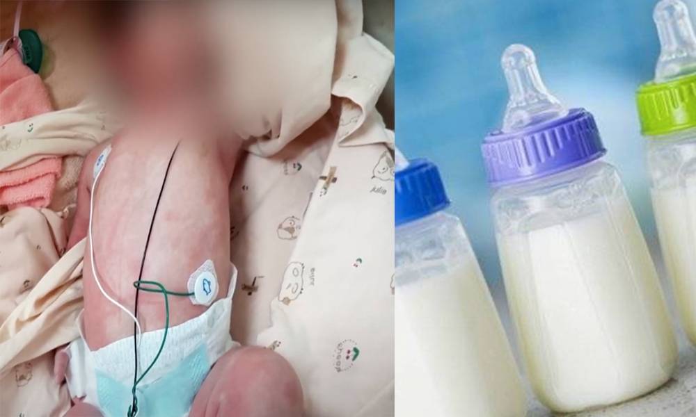 滿月女嬰全身紅疹險致敗血症 醫生揭錯誤沖奶方法引發細菌感染