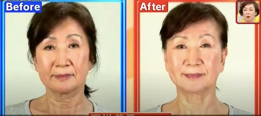 臉部下垂 臉部瑜伽 69歲的石川恭子原本在3星期後臉部輪廓明顯提升。
