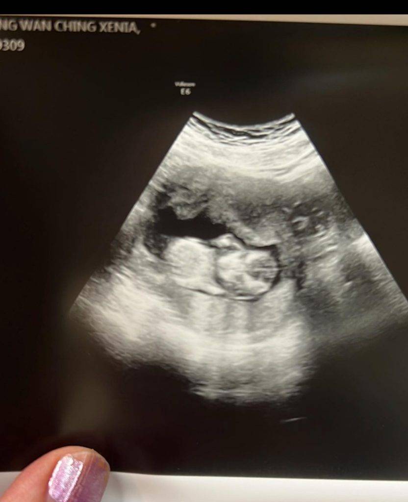 莊韻澄 上月底在社交平台公布再次懷孕，當時她更表示準備抽羊水檢查，也請大家一同集氣，希望胎兒一切安好。（圖片來源IG@xeniachong）