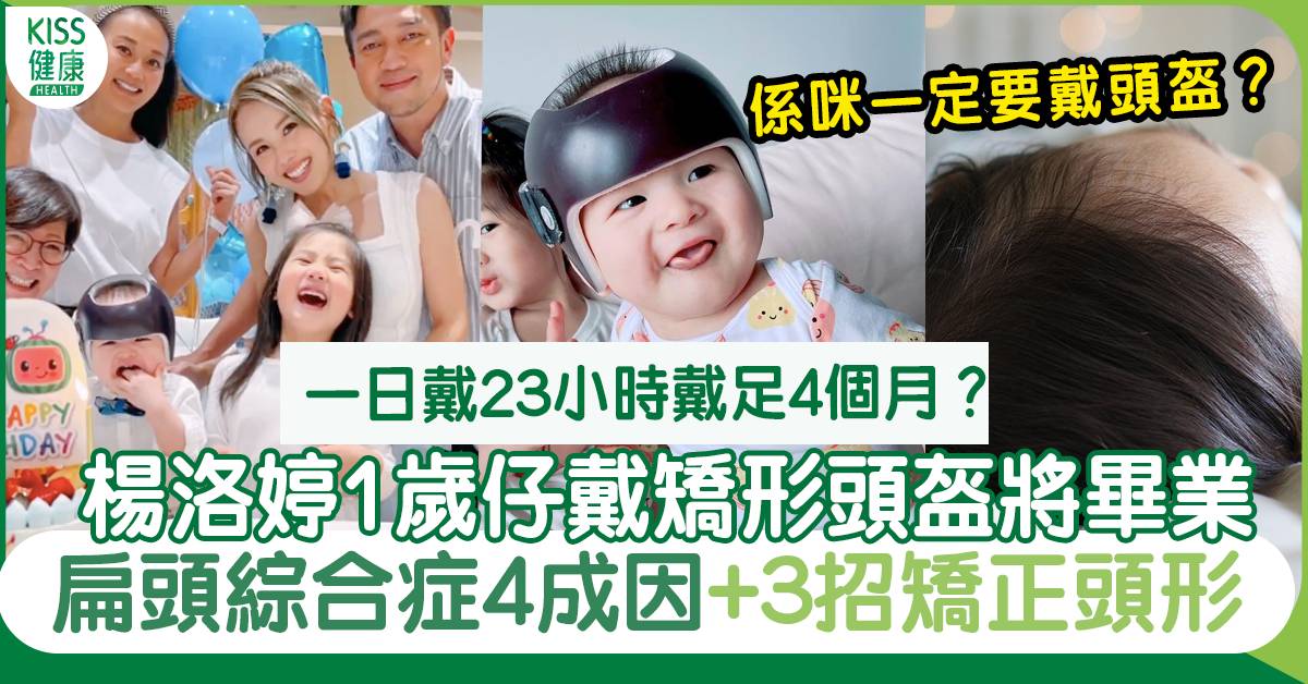 扁頭綜合症成因+預防｜楊洛婷1歲仔戴矯形頭盔4個月將畢業