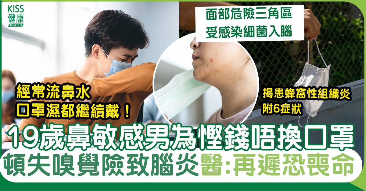 蜂窩性組織炎｜19歲鼻敏感男為省錢不換口罩險致命 1部位細菌感染要小心