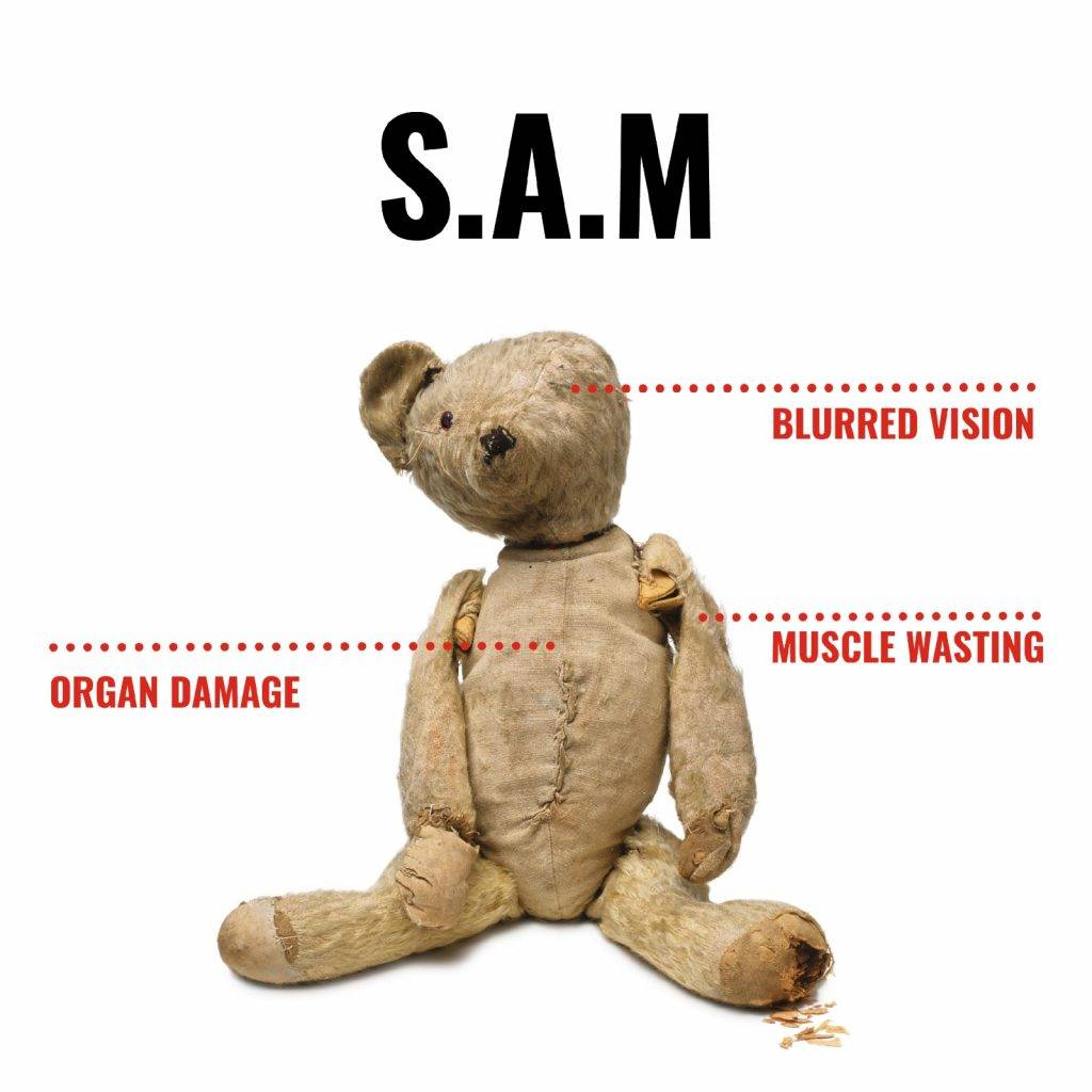 珍惜 可憐的熊啤啤SAM手臂凹陷、內臟受損，甚至視力模糊。