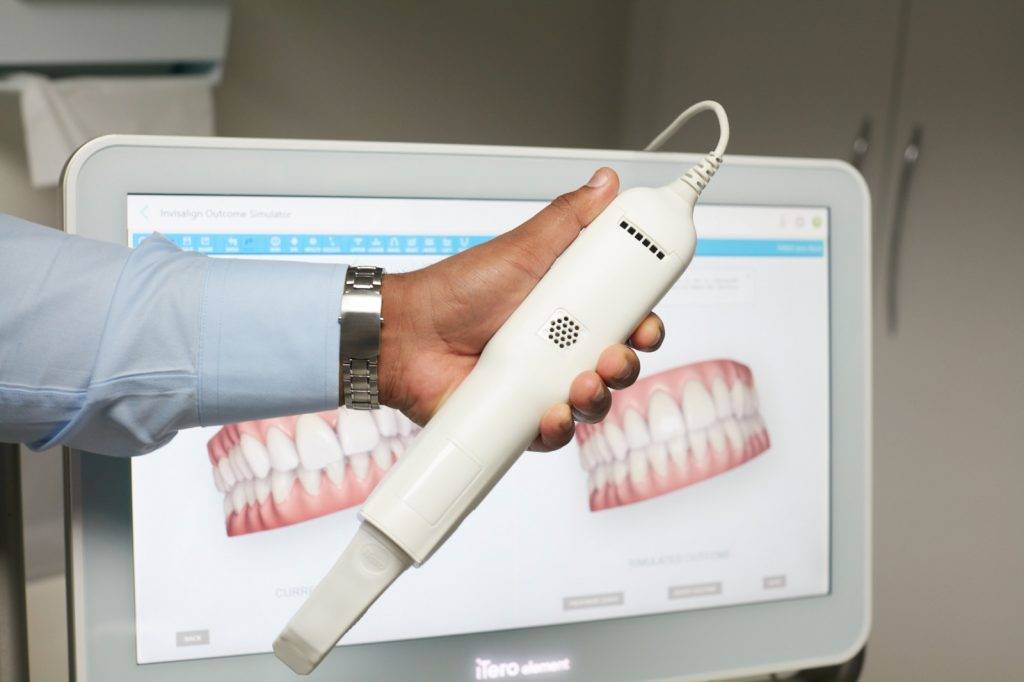 小朋友箍牙 iTero數碼口腔掃瞄器能監測和預視牙齒的變化。