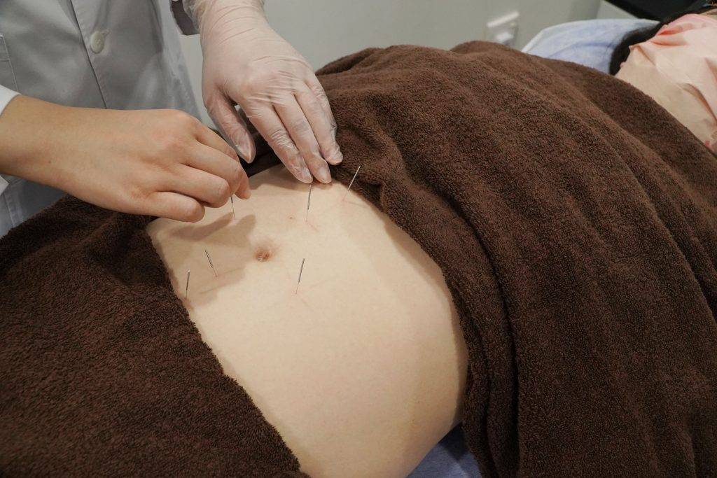子宮 再依照個人體質進行穴位針灸，以調節子宮功能。