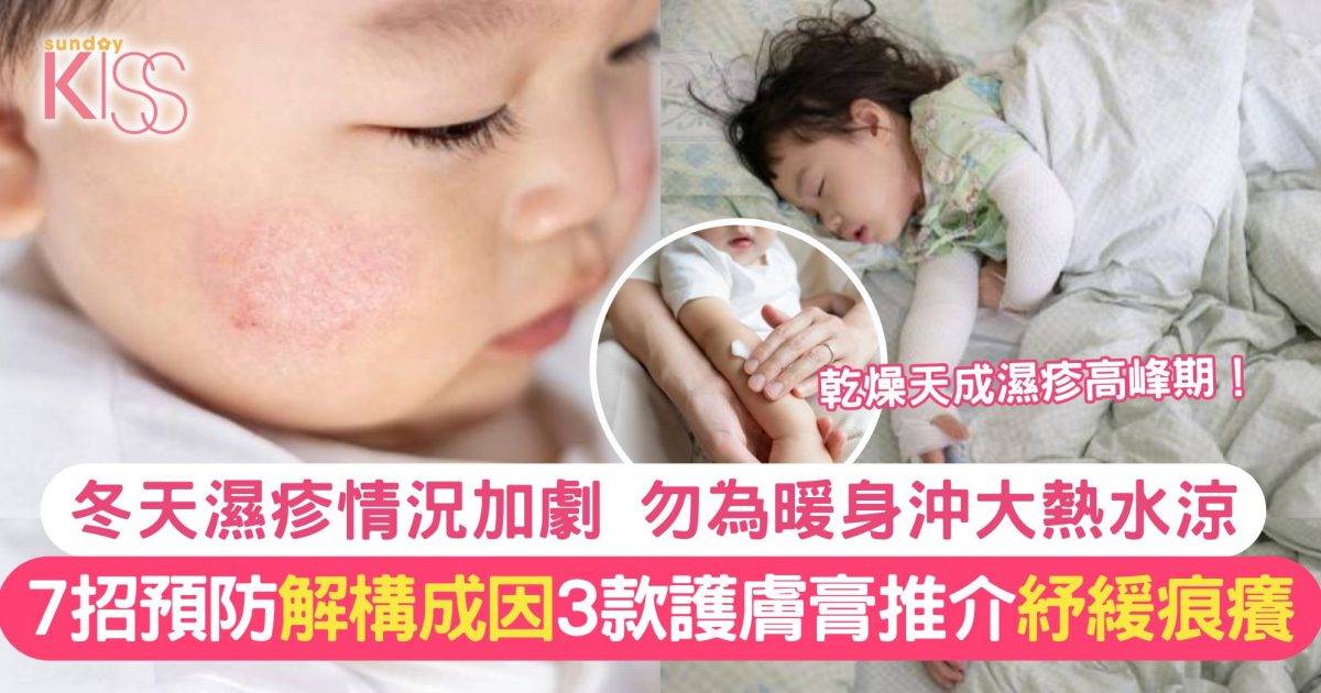 冬天濕疹｜乾燥性濕疹發病高峰！7招預防冬天濕疹、冬季護膚要補油補水 附3大護膚膏推介