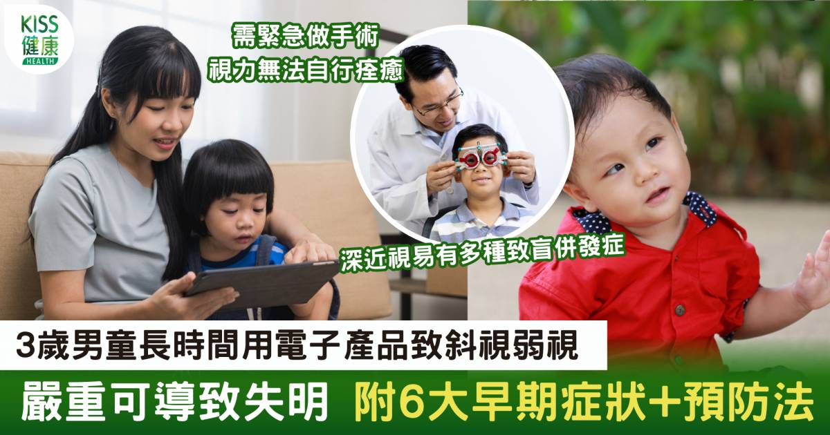 斜視症狀+預防|3歲兒常用電子產品致斜視弱視 無法自行痊癒需緊急手術
