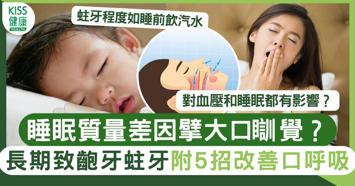 口呼吸｜擘大口瞓覺易患睡眠障礙、蛀牙、咬合不正 附5招改善口呼吸