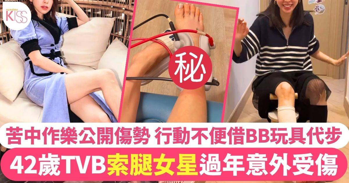 42歲TVB索腿人妻過年前黑仔受傷  公開傷勢苦中作樂借囡囡玩具代步