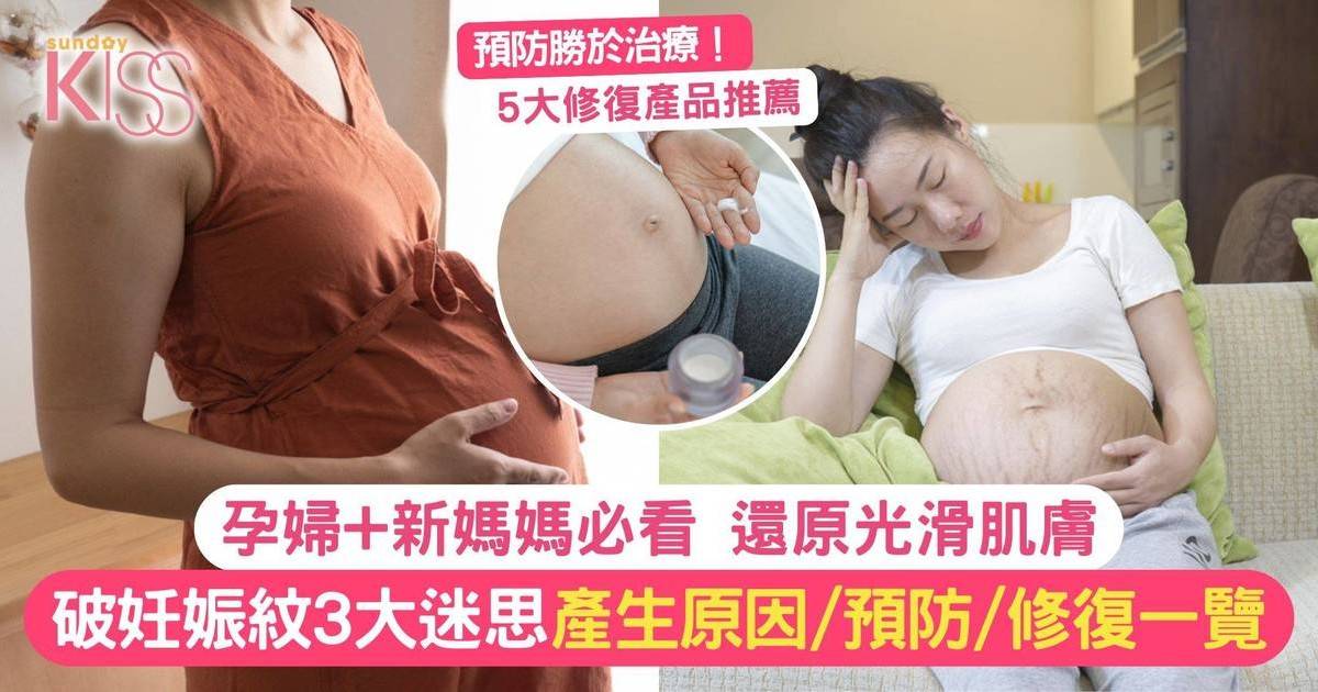 妊娠紋｜破妊娠紋3大迷思 妊娠紋=橙皮紋？妊娠紋會消失嗎？