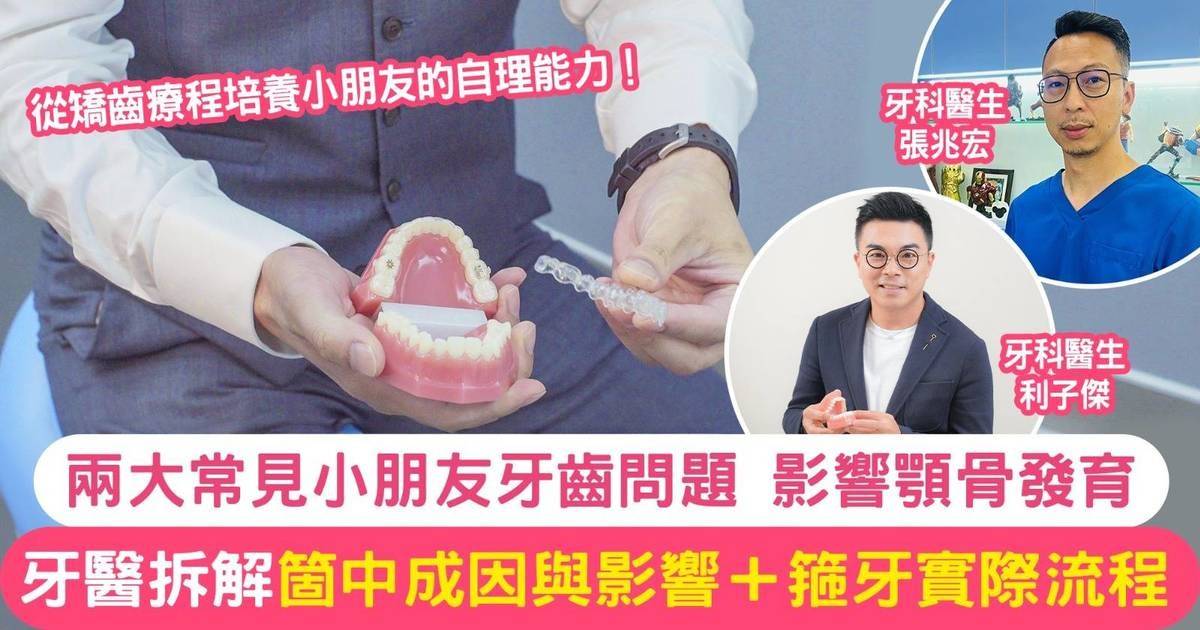 小朋友換牙期牙齒問題特別多？一文看清常見的兒童牙齒問題、矯齒流程和牙醫重要性