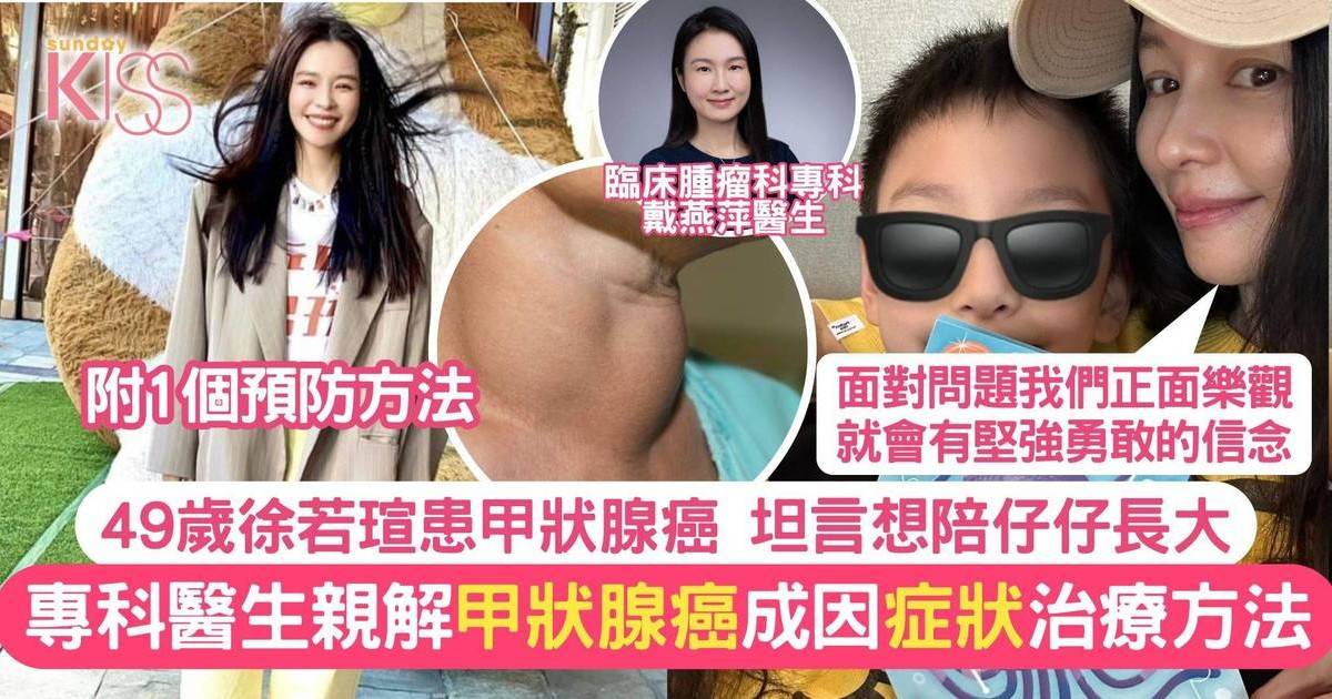 49歲徐若瑄患甲狀腺癌 坦言想陪仔仔長大 附醫生解構治療＋成因＋症狀