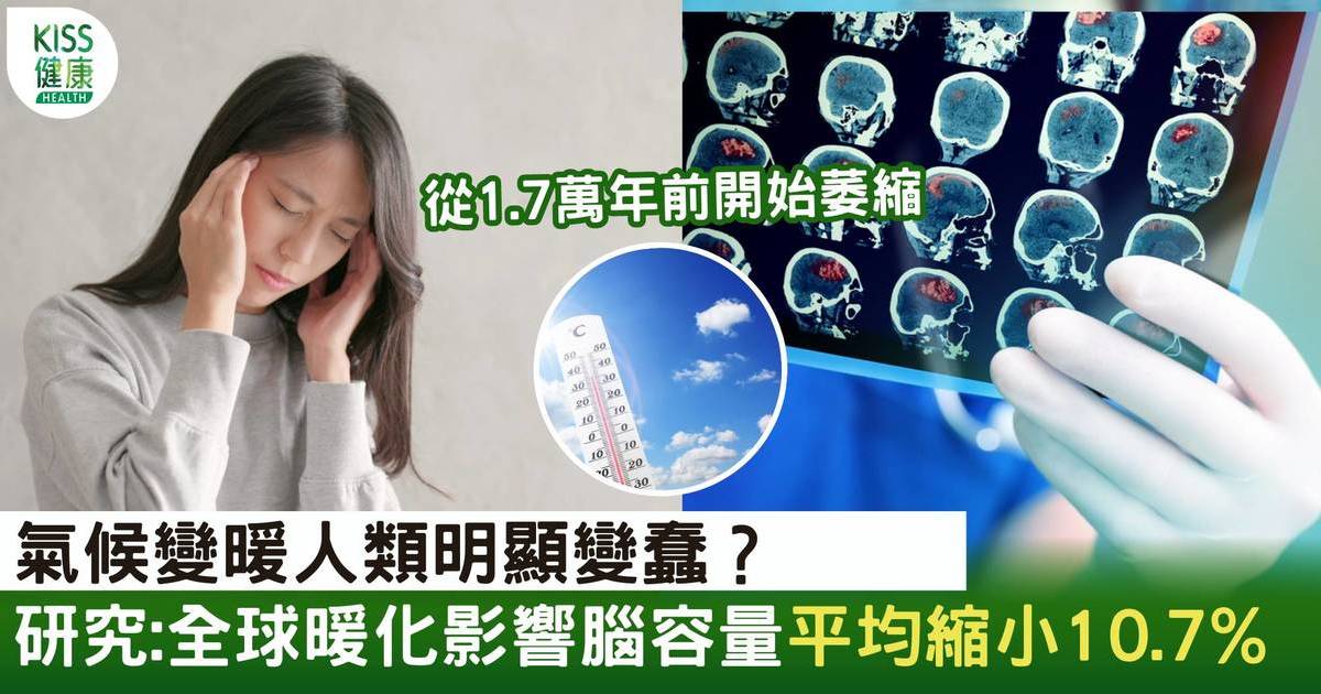 全球暖化影響腦容量？研究：大腦平均縮小10.7%