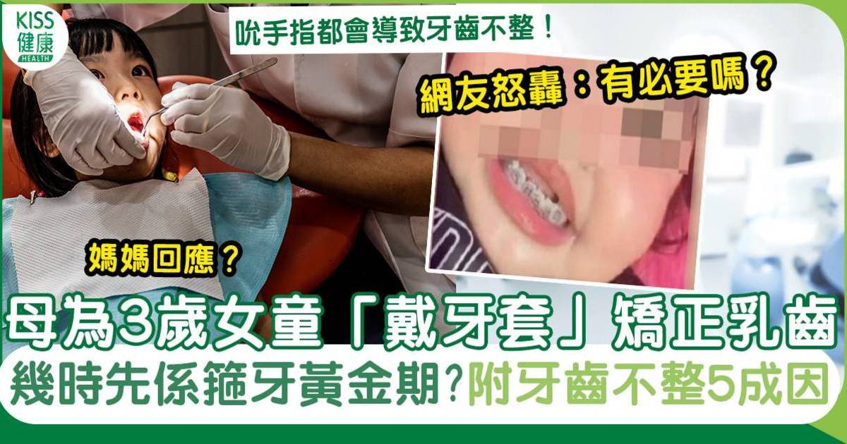 箍牙｜母為3歲女童戴牙套矯正乳齒 被網友怒轟：有必要？附箍牙黃金期