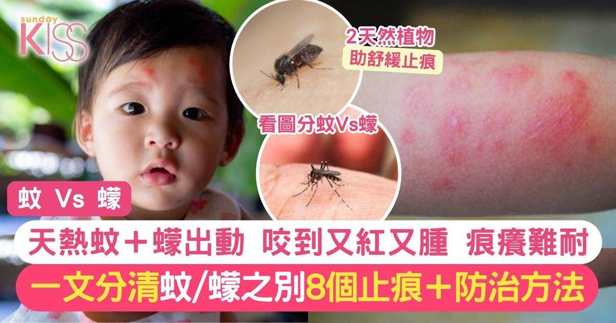 蚊叮腫痕難耐 蚊與蠓難分辨 一文睇4個止痕方法及4個防治策略