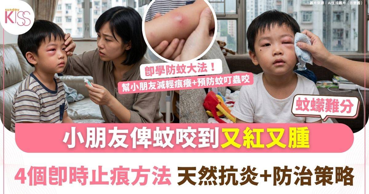 蚊叮腫痕難耐 蚊與蠓難分辨 一文睇4個止痕方法及4個防治策略