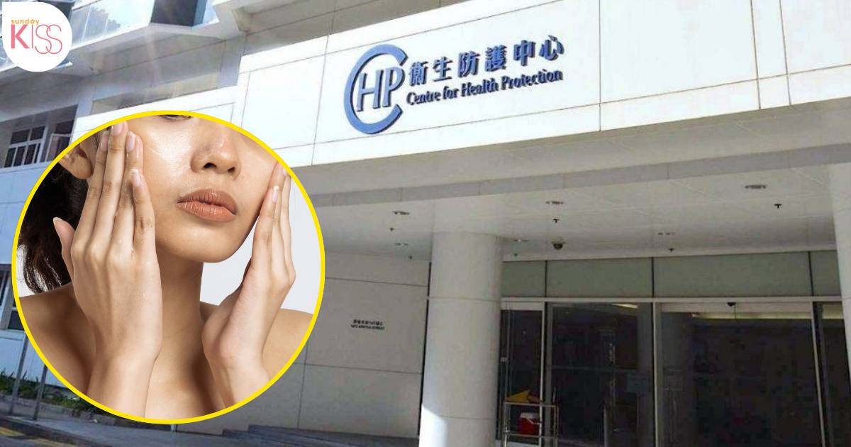 44歲女子用1款面霜 水銀中毒急入院 衞生署呼籲立即停用 附產品資料