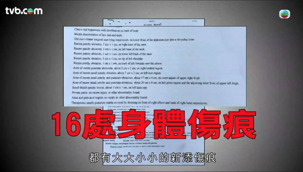 東張西望 天寶 (圖片來源:TVB)