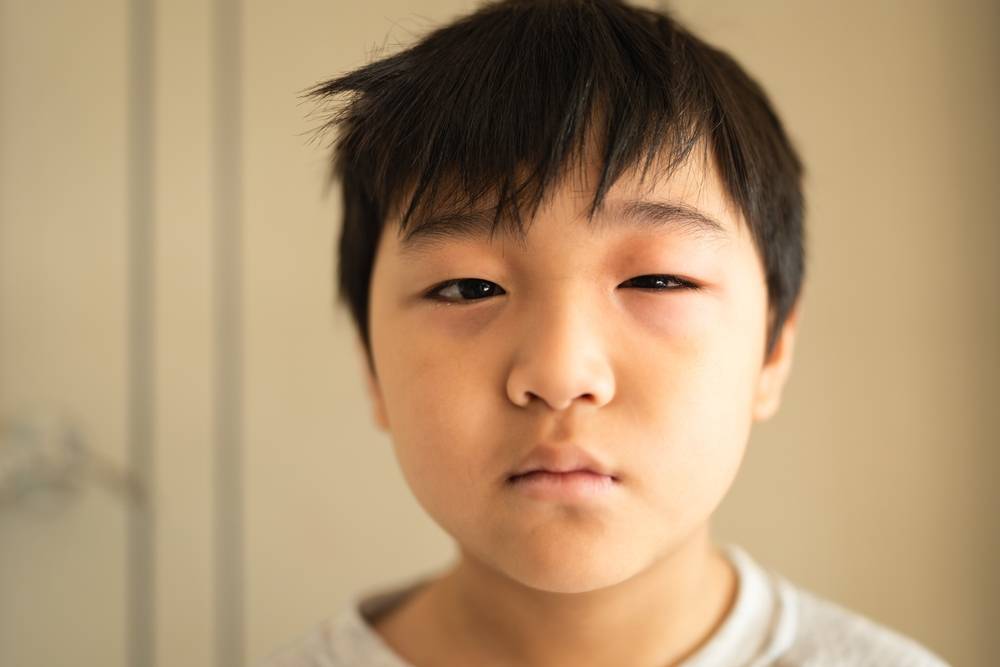 夏日養生 (圖片來源:Shutterstock)