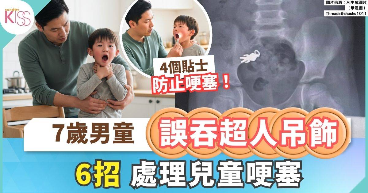 兒童誤吞異物｜7歲男童邊意外把超人吊飾吞下 附處理兒童哽塞方法