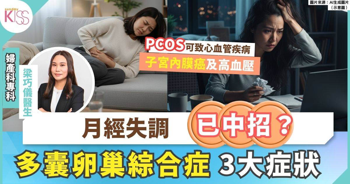 多囊卵巢綜合症成都市婦女常見病？3大症狀及專家建議治療與管理方法