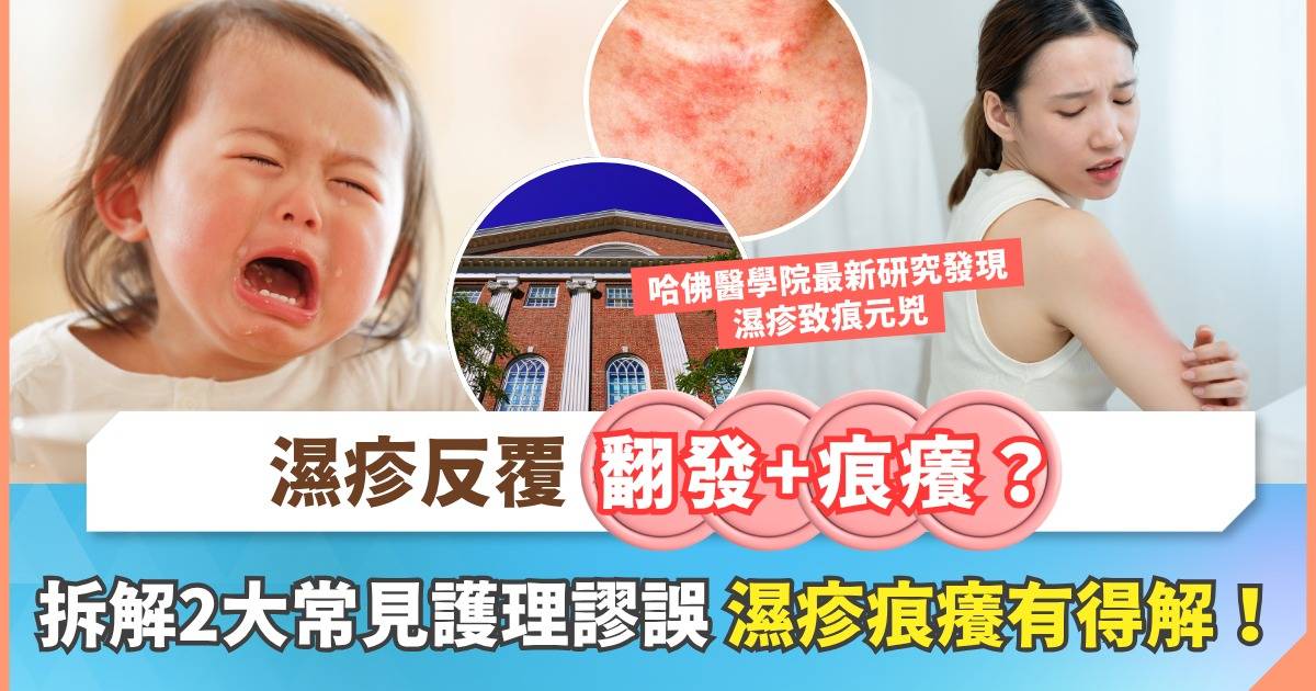 Protected: 小朋友轉季濕疹大作戰：拆解濕疹常見迷思 哈佛研究鎖定「痕癢元凶」！
