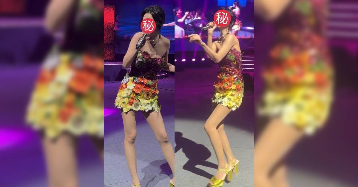 44歲人氣女星年會性感演出 暴瘦胸口現肋骨 網民憂心
