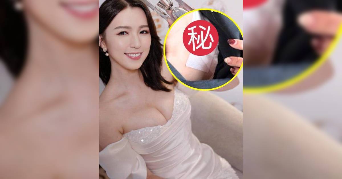 孫慧雪頸部貼紗布身體響警號！自爆兩處地方傷患嚴重