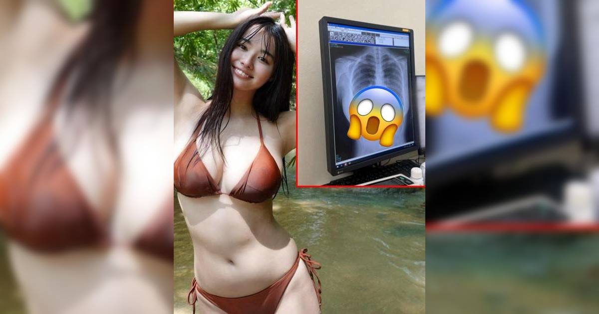 23歲日本最強body曬X光照「肺部健康」超邪惡線條狂吸3千萬瀏覽！