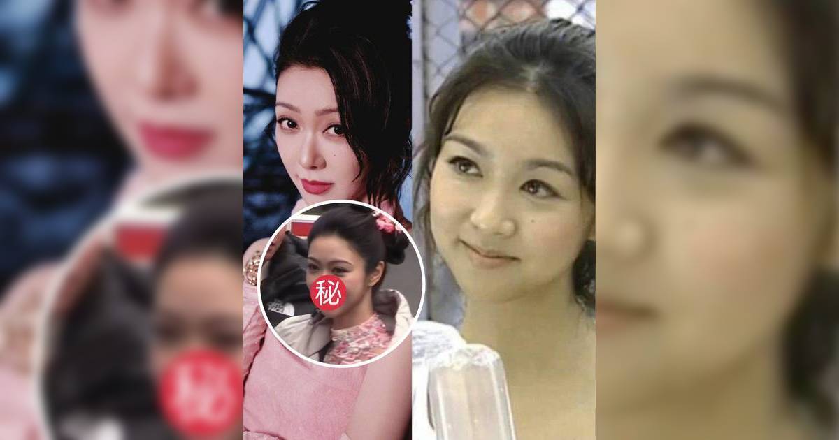 44歲薛凱琪生圖流出真容曝光 一部位變化惹醫美質疑