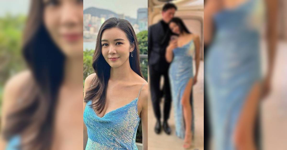 34歲麥明詩同一晚裝3年前後對比變化驚人 曾因陀B身材焦慮火速修身