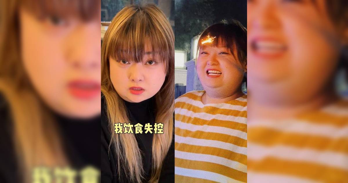 細細粒復胖後飲食失控陷焦慮情緒不敢見人 近況曝光一個改變獲網民大讚