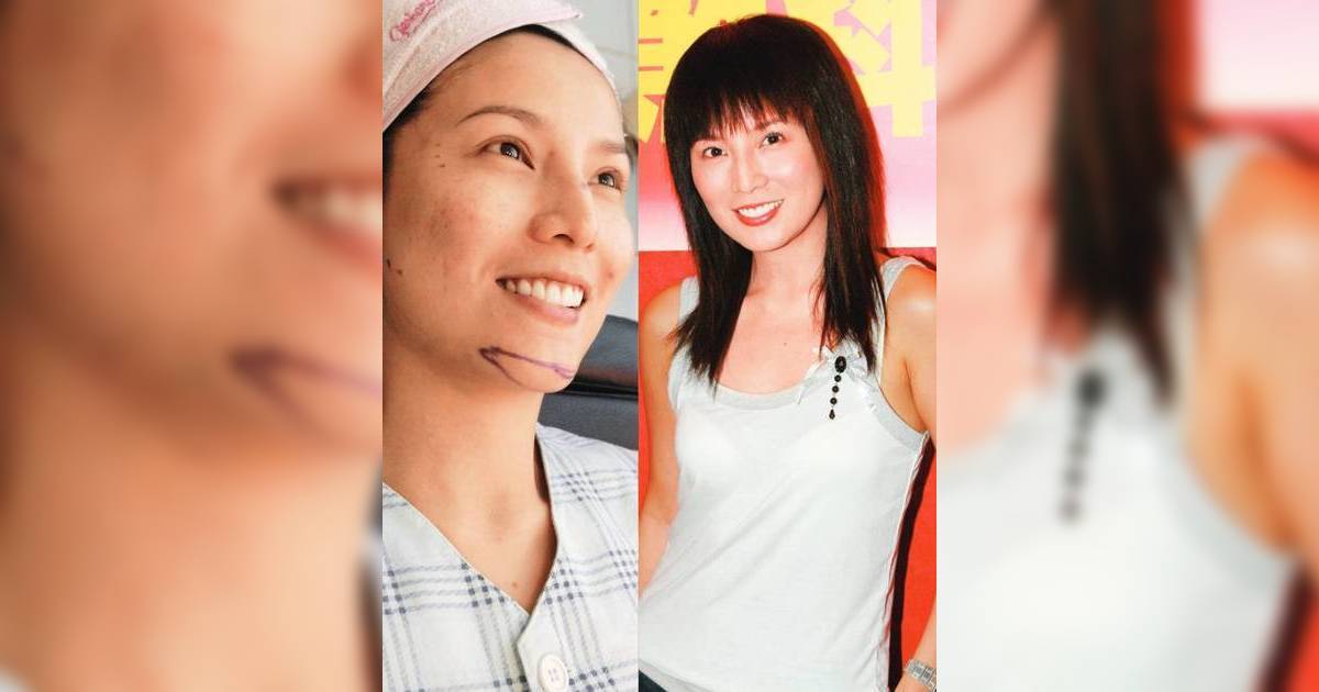 吳文忻離世｜當年收百萬酬勞整容背後全因一句話 成為香港首個公開的「人工美女」