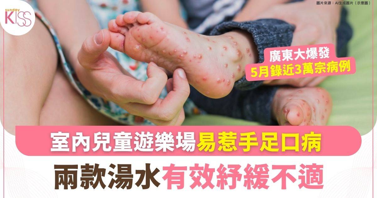 兒童健康｜深圳爆手足口病 室內遊樂場成重災區 中招後必飲2款湯水