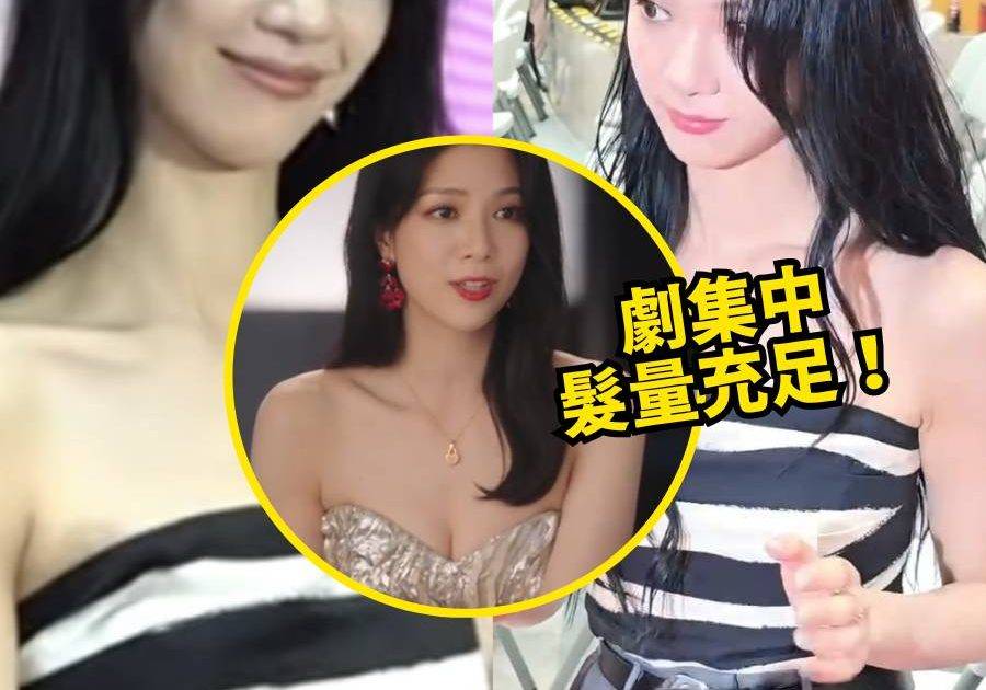 31歲陳曉華「髮縫變寬」疑爆「壓力禿」情傷加上工作量超標網民直呼心痛