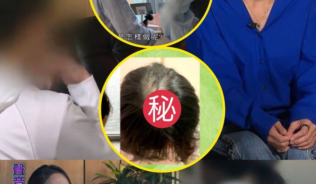 東張西望｜脫髮少女4千元紋髮挽戀情 兩日後竟驚見更崩潰下場