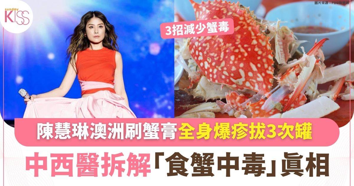 陳慧琳澳洲刷蟹膏全身爆疹拔3次罐 中西醫拆解「食蟹中毒」真相